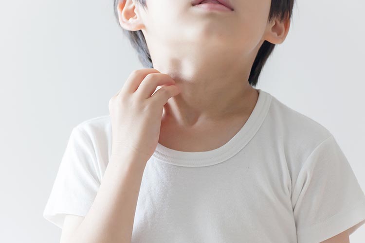 アレルギー画像